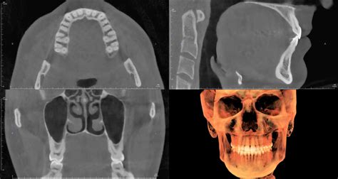 All CBCT Educational Resources .